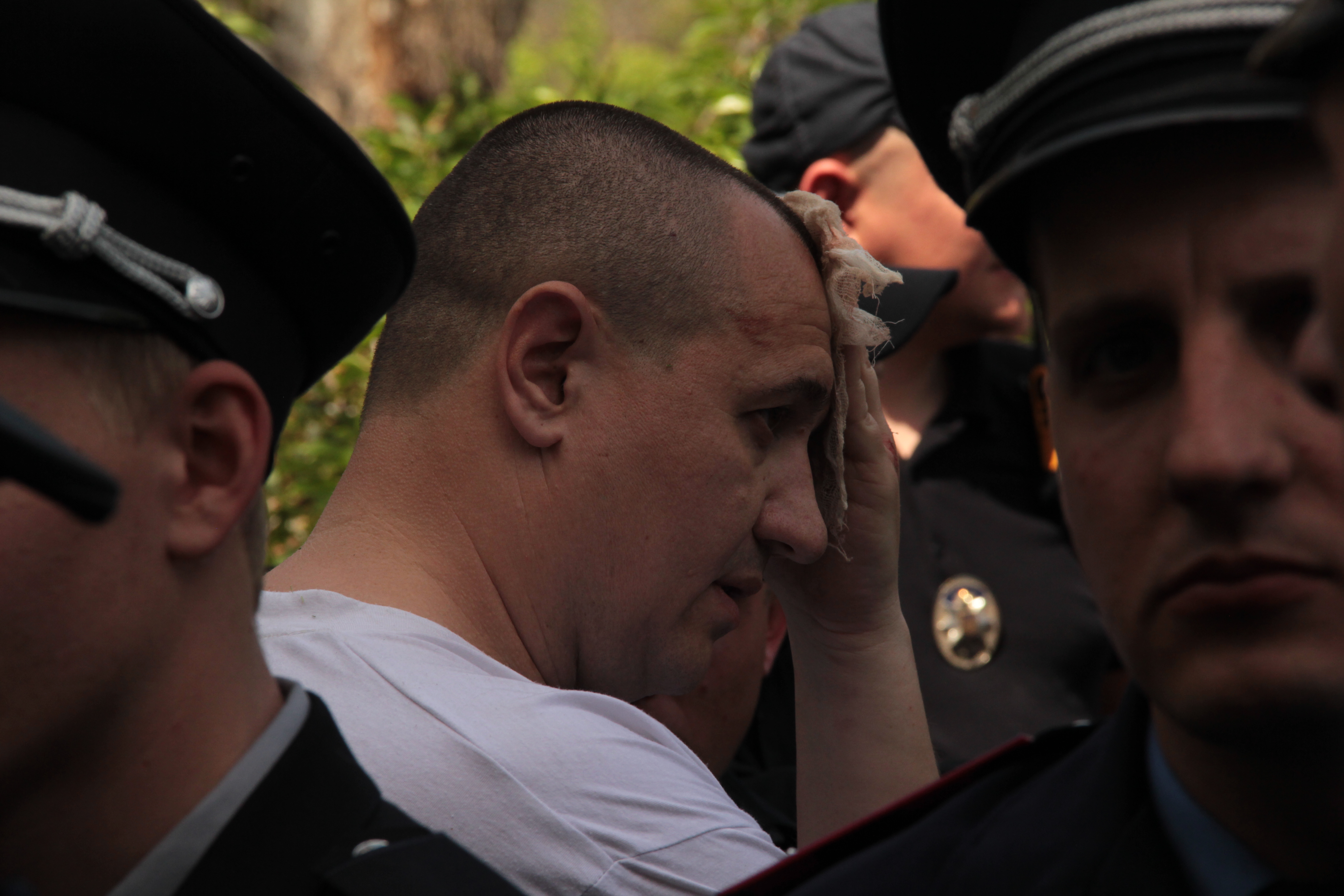 Постраждалого у сутичках охороняють від проукраїнських активістів поліцейські